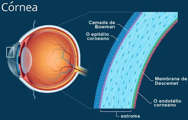 Imagem mostra as camadas da córnea (lente da frente do olho): o epitélio é a camada superficial e é retirado no crosslinking para permitir a penetração do colírio de riboflavina que vai interagir com a radiação ultravioleta