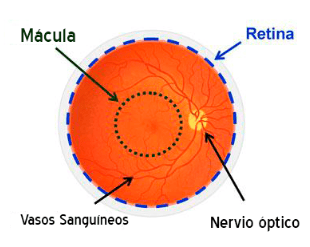 Problemas na retina e na mácula: visão embaçada
